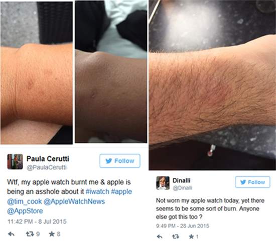 Apple Watch也過熱：導致用戶皮膚灼傷
